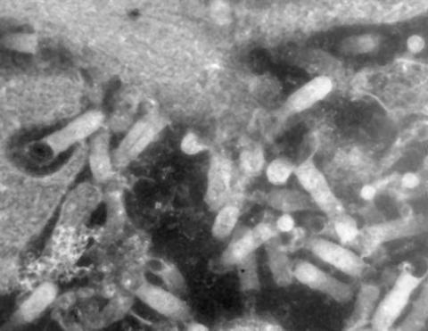 Electron micrograph of VHSV particles