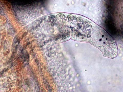 Adult dactylogyrus showing its 4 eyespots.