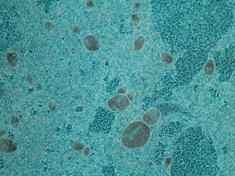 Ichthyophthirius under phase contrast illumination.