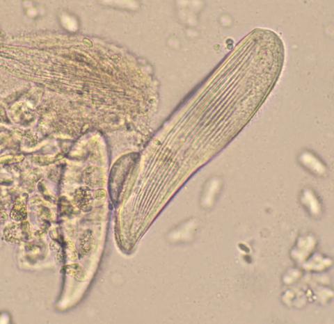 Cilliate showing lines of cillia (hairs)