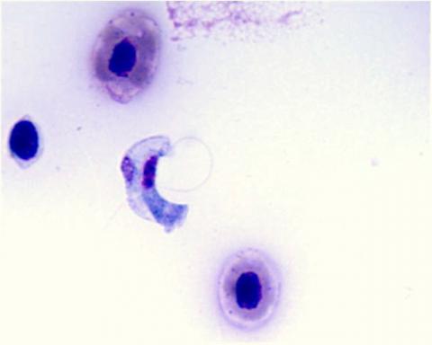 Stained blood smear showing the hemoflagellate Cryptobia salmositica.