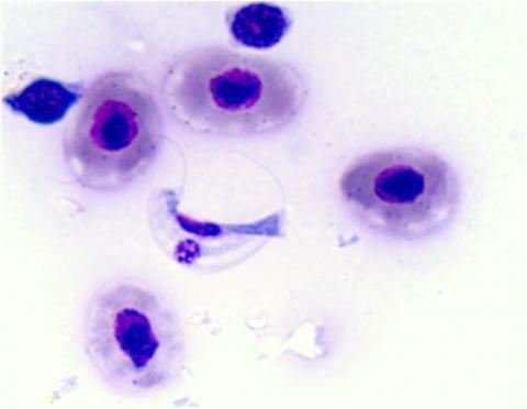 Stained blood smear showing the hemoflagellate Cryptobia salmositica.