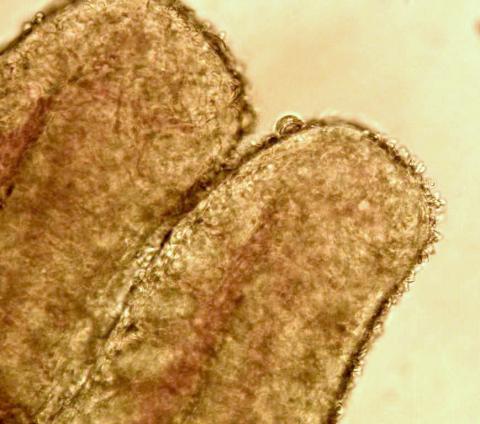 Ichthyobodo on gill filament.