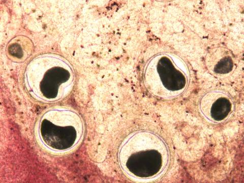 Nanophyetus metacercaria in fresh tissue squash.