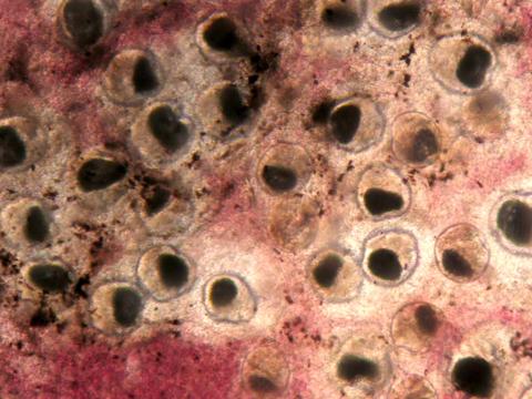 Nanophyetus metacercaria in fresh tissue squash.