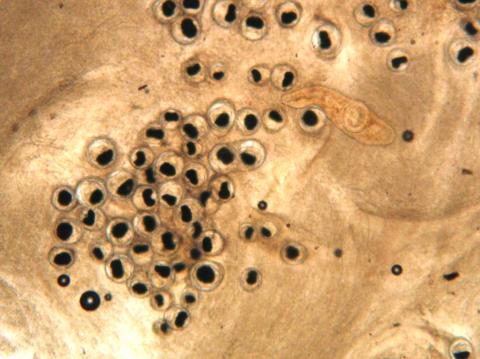 Nanophyetus metacercaria in fresh tissue squash.