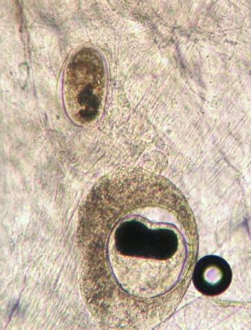 Metacercaria of Nanophyetus and an unknown trematode in fresh tissue squash.