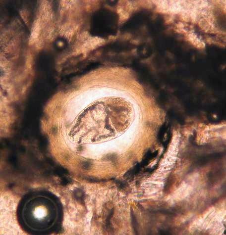 Neascus metacercarium glowing brightly where it lets light through a thick tissue squash.