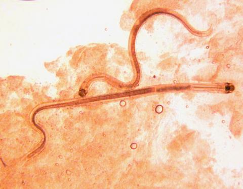 Adult Camallanus nematodes.