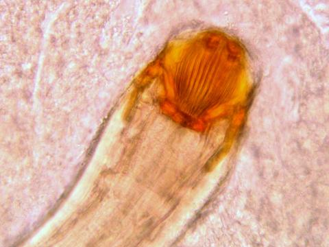 Distinctive mouthparts of Camallanus nematode.