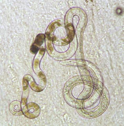 Adult Capillaria nematode.