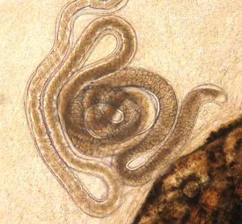 Adult Capillaria nematode, filled with eggs.