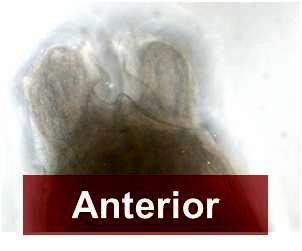 Anterior (head) end of Hysterothylacium sp. nematode.