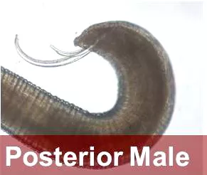 posterior of male Hysterothylacium sp. nematode.