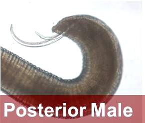 posterior of male Hysterothylacium sp. nematode.