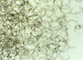 A mass of adult Philonema nematodes.