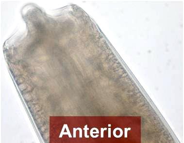 Anterior (head) end of adult Salvelinema nematode.
