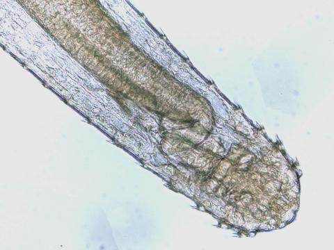 Anterior (head) end of adult Spinitectus nematode.
