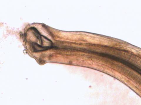 Mouthparts of a Truttaedacnitis nematode.