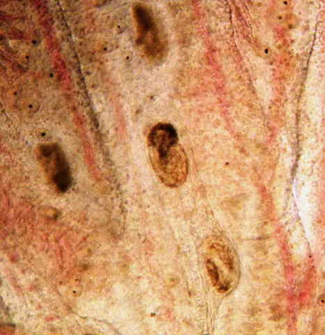 Trematode metacercaria in gills.