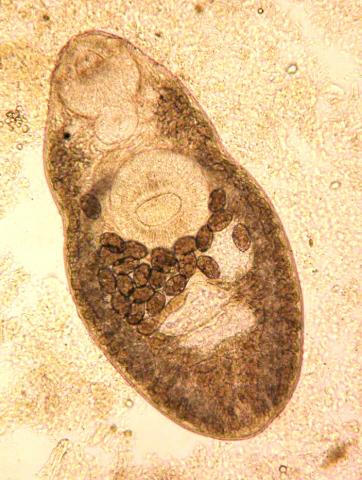 Adult trematode from gall bladder.