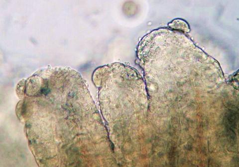 Trichodinella on gills.