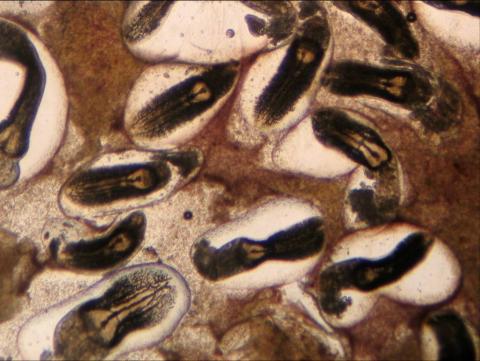 High magnification view of liver squash showing heavy infestation of white grub.