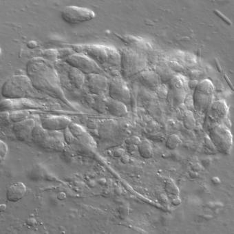 Plasmodium of developing Myxobilatus 11M21 myxospores.