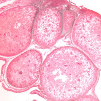 Glugea xenomas in kidney