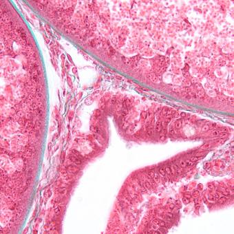 Boundary between host and glugea xenoma