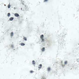 Hexamita in stained skin smear