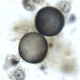 Ichthyobodo in fish skin smear.