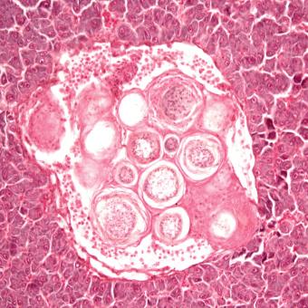 Histological image showing muscle tissue infected with ichthyophonus. 