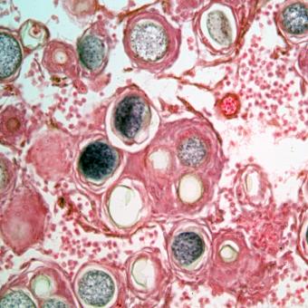Histological image showing muscle tissue infected with ichthyophonus. 