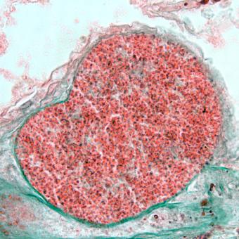 Loma cyst in gill filament.