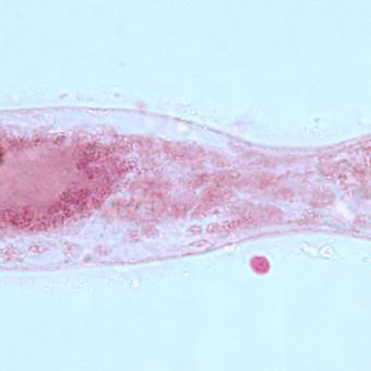 Sanguinicola blood fluke miracidium