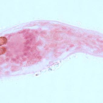 Sanguinicola blood fluke miracidium