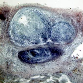 Tissue section showing mycobacterium lesion in sculpin.