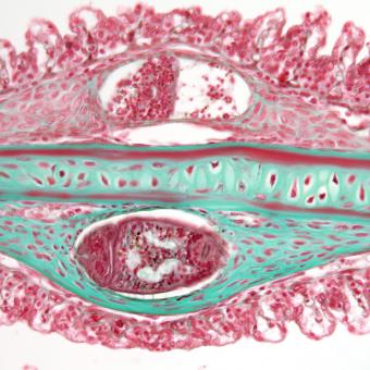 Tissue section showing a trematode metacercaria in steelhead gill filament.