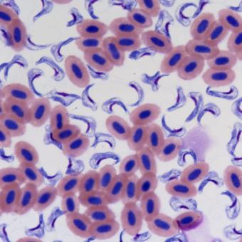 Stained blood smear showing hemoflagellates.