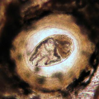 Trematode metacercaria from skin of coho salmon.