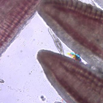 Dactylogyrus on gill filaments.