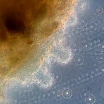 Characteristic "columns" of Flavobacterium.