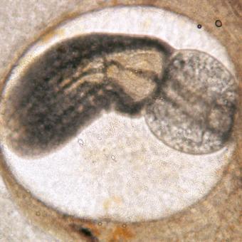 Trematode metacercaria.