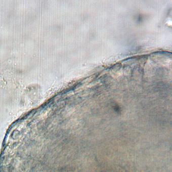 Filamentous flavobacteria on surface of gill.