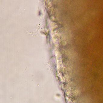 Filamentous flavobacteria on surface of gill.
