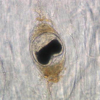 Metacercaria of Nanophyetus in muscle.