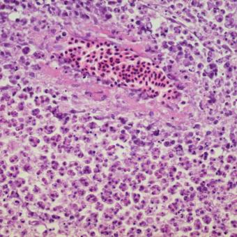 Tissue section showing Ceratomyxa shasta myxospores developing in intestinal wall.