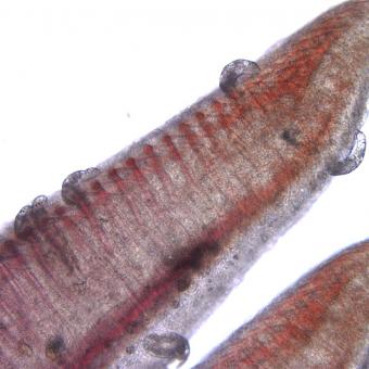 Dactylogyrus on gill filaments.