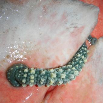 Pontobdella loricata leech on a shark.